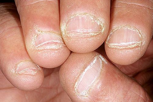 Kā apzināties un ko darīt vielmaiņas traucējumu gadījumā